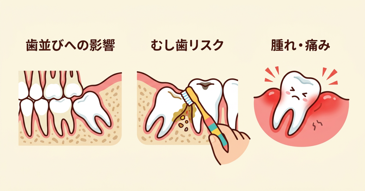 ■親知らずを抜かないとどうなる？放置で起こりうるデメリット