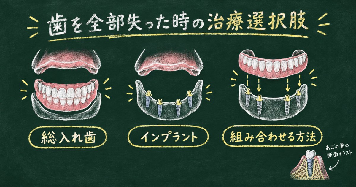 全抜歯を告げられたら？歯を全部失った時の治療選択肢と特徴